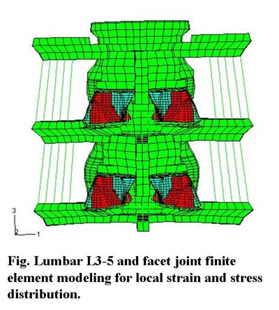 Spinal Biomechanics and Pain FE Model