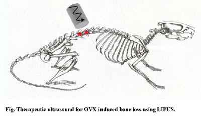 Therapuetic Ultrasound on OVX Rat Spine